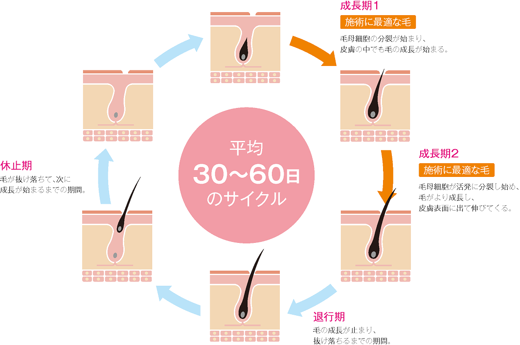 脱毛方法の比較表