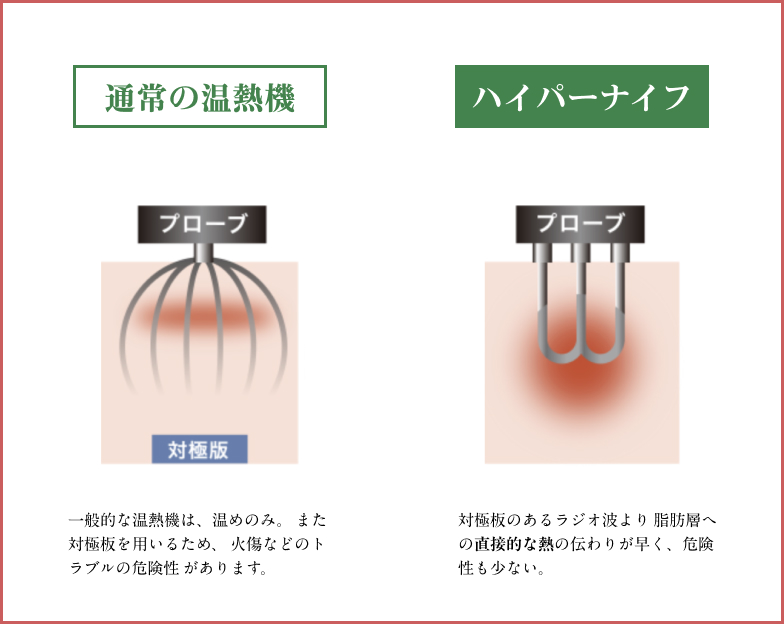 温めの効果